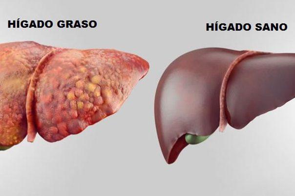 graso_0-e1623264192570