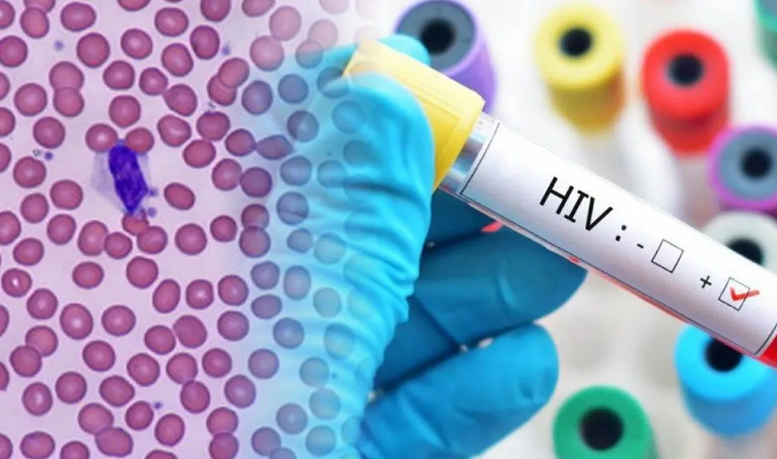 hiv-