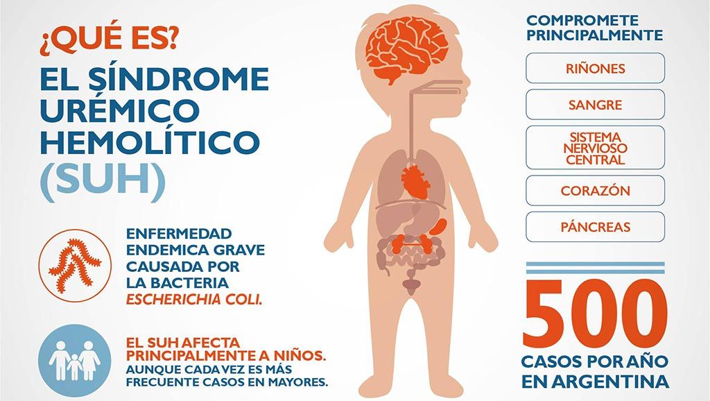 sindrome