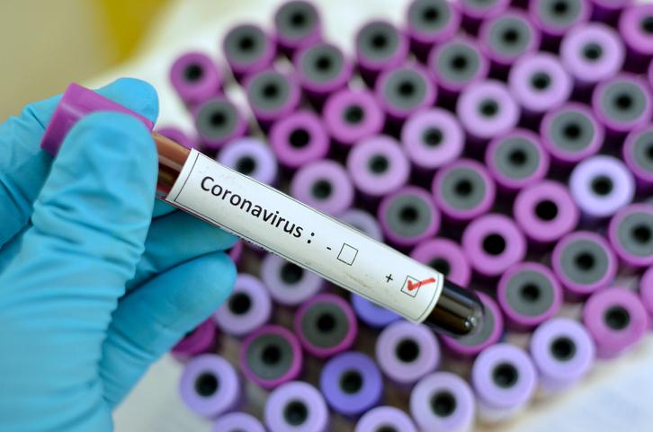 coronavirus1